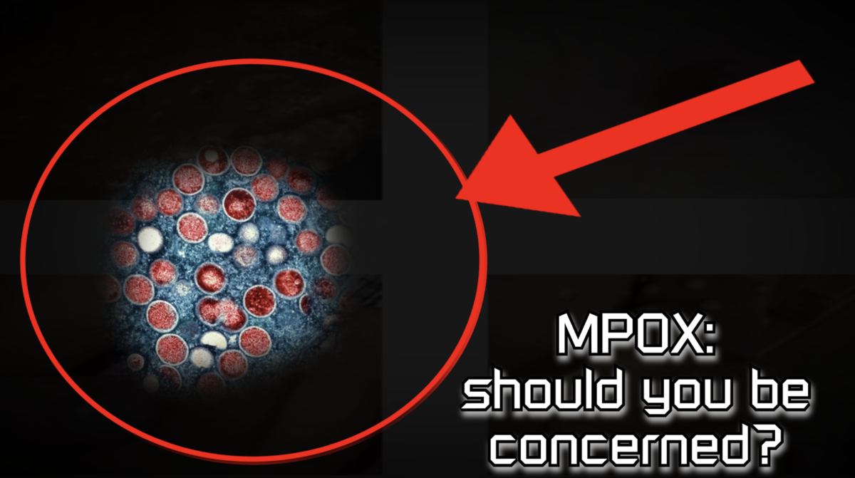 MPOX: Is there a concern?